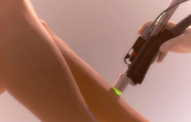 BareUK Laser Hair Removal Motus AY BareUK Laser Hair Removal Motus AY