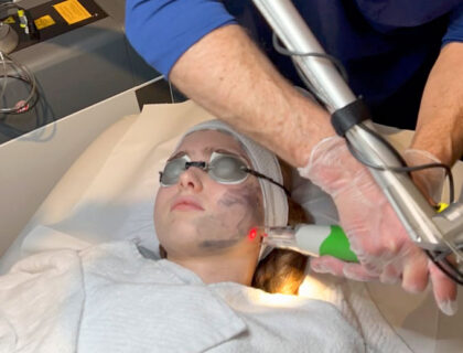 Carbon-Facial-2 Carbon-Facial-2